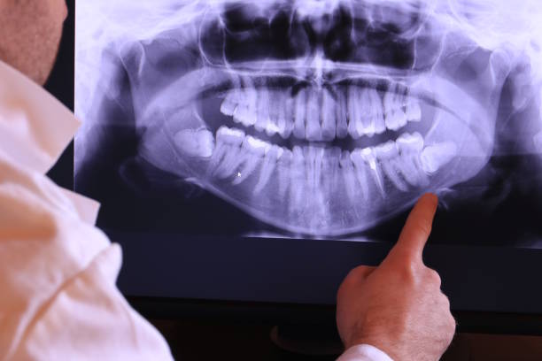 Best Emergency Treatment for Jaw Pain or Injury in Trotwood, OH